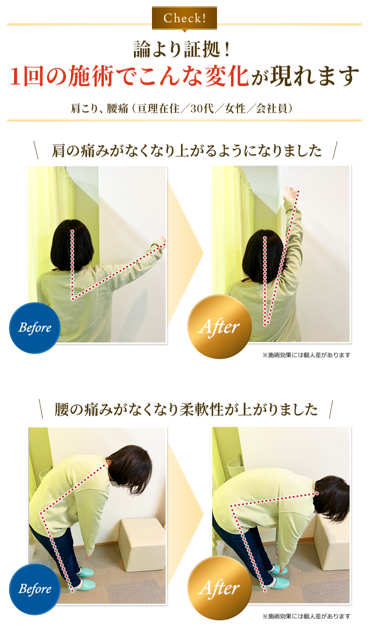 論より証拠!1回の施術でこんな変化が現れます(肩こり、腰痛の改善事例)
